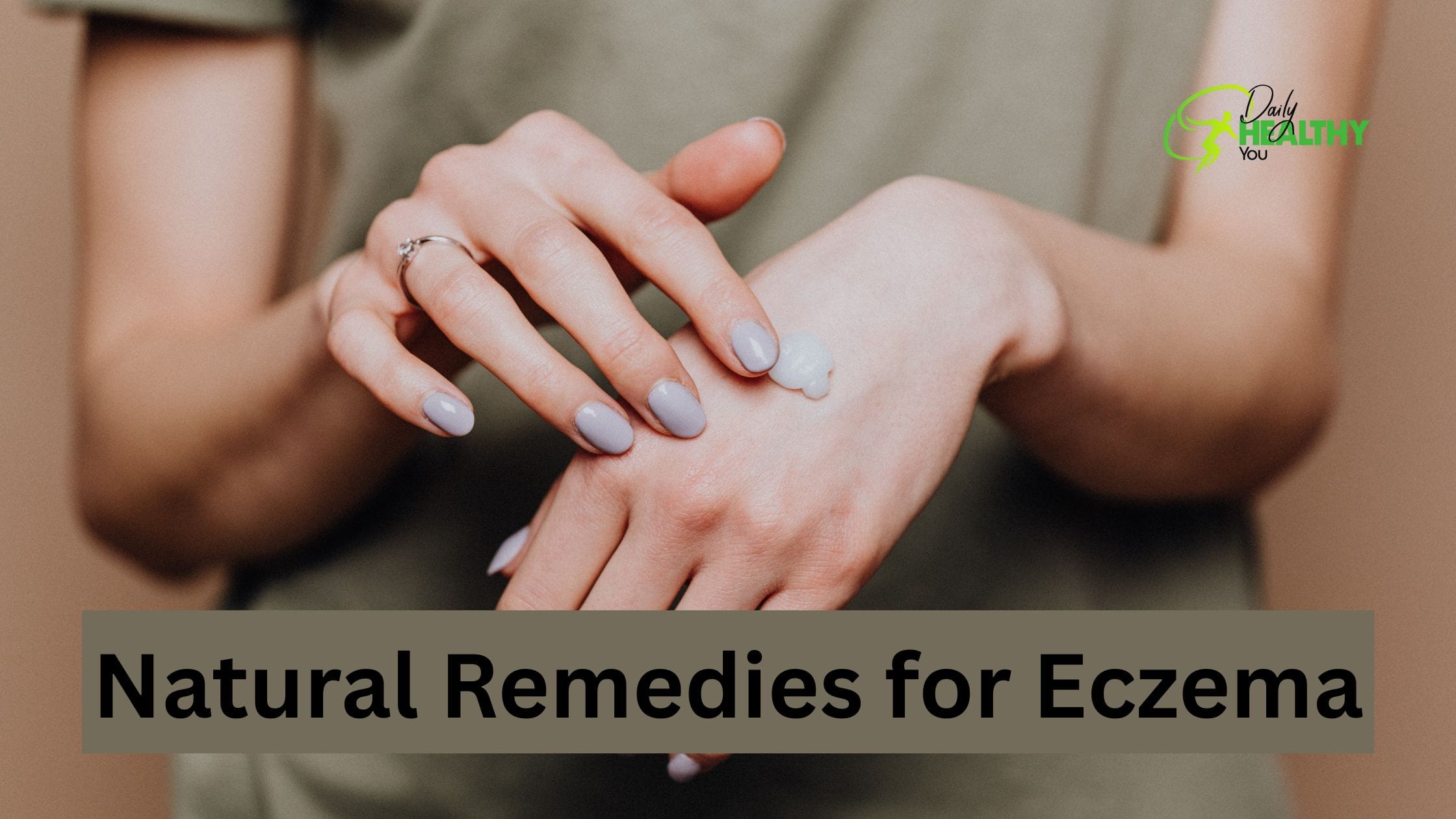 7 Natural Remedies for Eczema