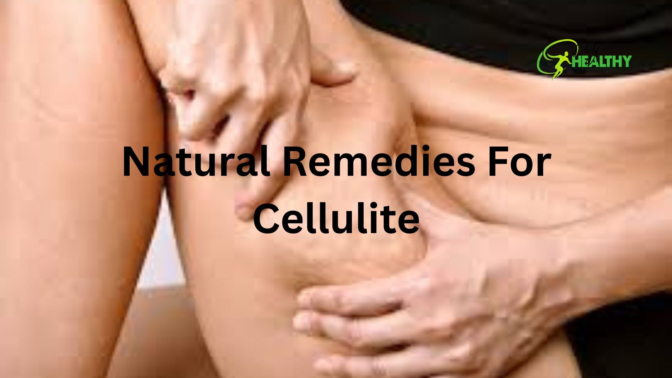 9 Natural Remedies for Cellulite